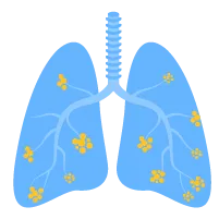 Trị liệu hô hấp