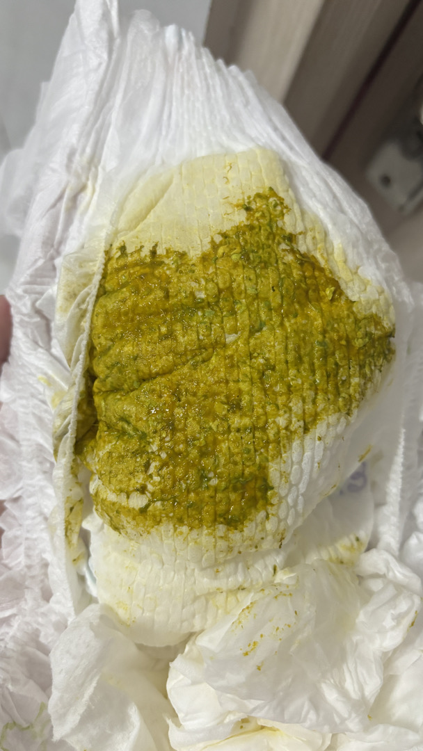 PHÂN EM BÉ CÓ HẠT LỢN CỢN XANH RÊU/ĐEN