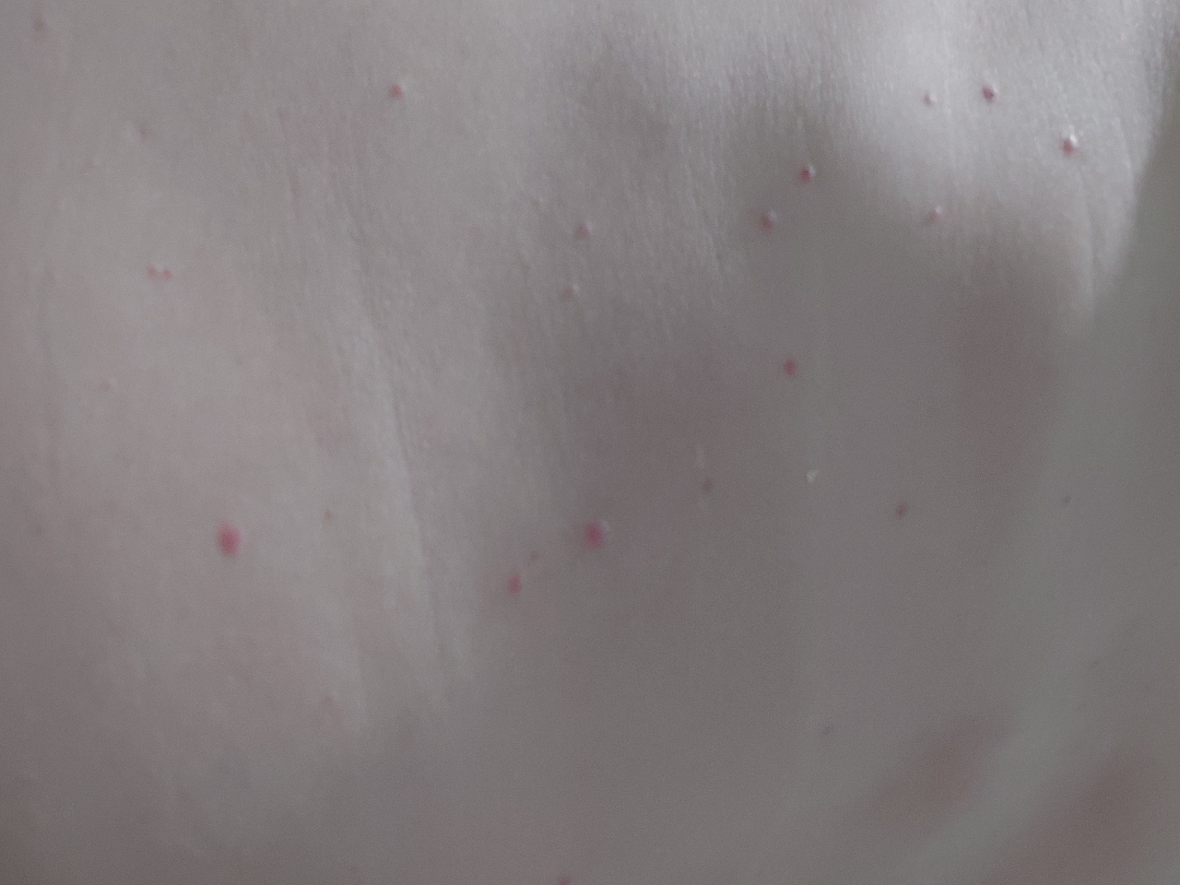 Liệu có phải smg