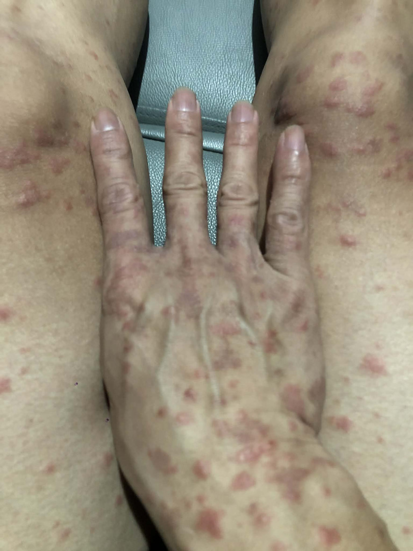 bác sỹ ơi cho e hỏi như này là bệnh gì a