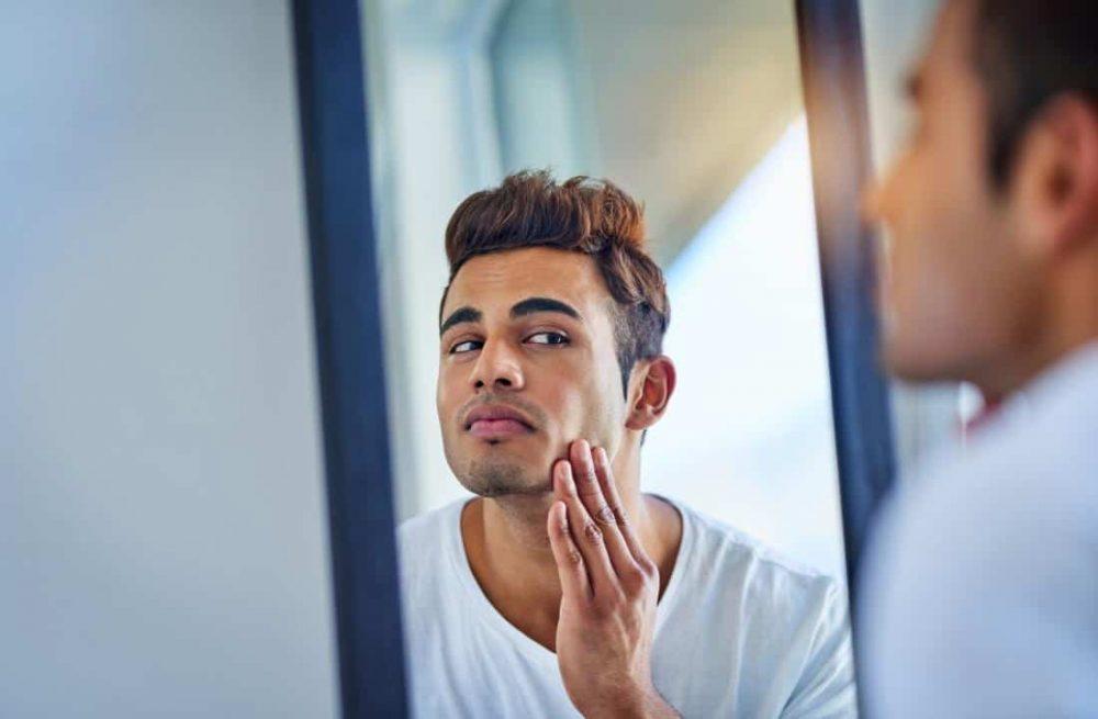 nguyên nhân mụn trứng cá