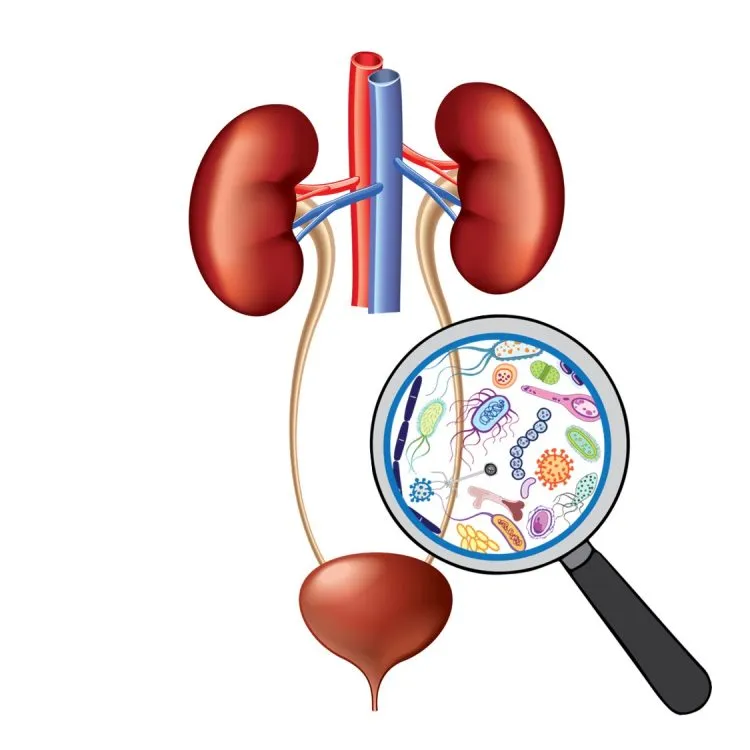 nhiễm trùng đường tiết niệu