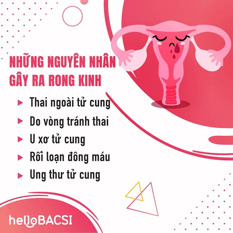 Nguyên nhân khiến chị em bị rong kinh (nguyên nhân bị rong kinh)
