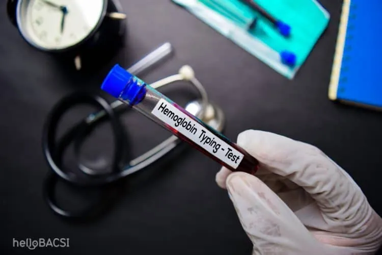 xét nghiệm hemoglobin