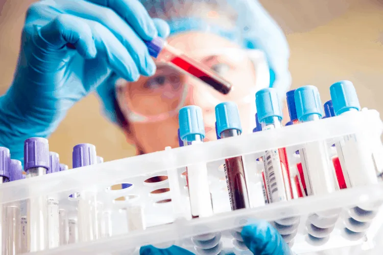 ống máu xét nghiệm