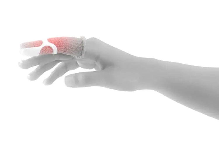 cách chữa bong gân ngón tay