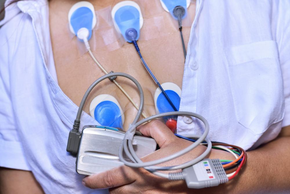 đo điện tâm đồ lưu động hay holter ecg là gì?