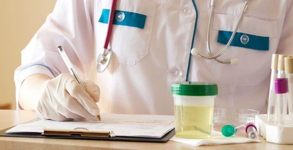 Chọn bộ xét nghiệm nước tiểu tại nhà