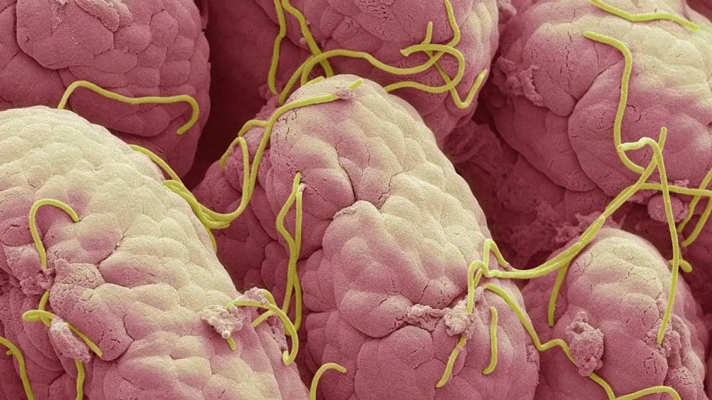 hình ảnh giun kim