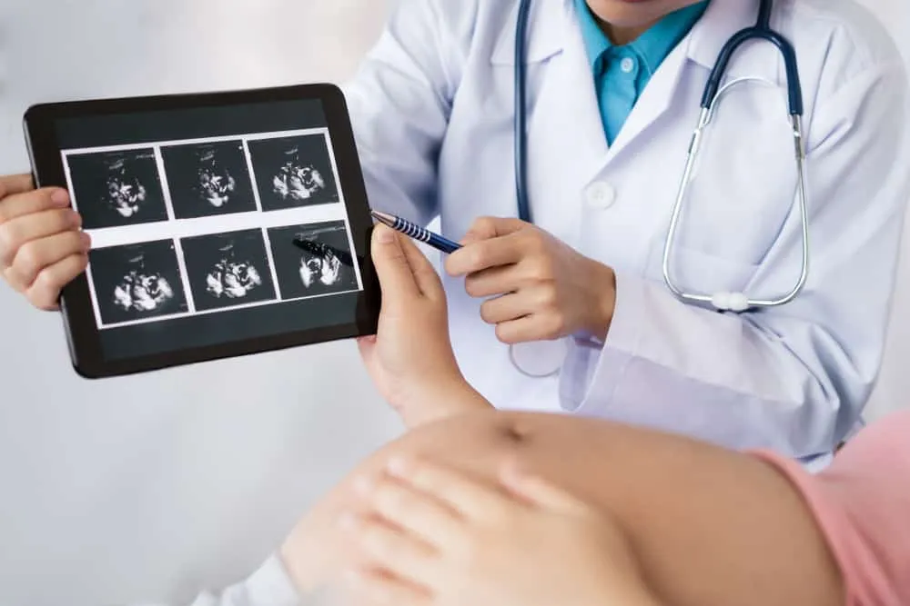 kiểm tra thai 33 tuần