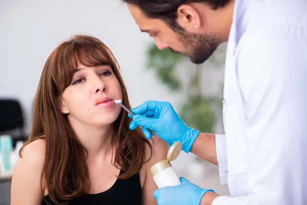 bị mụn rộp môi 