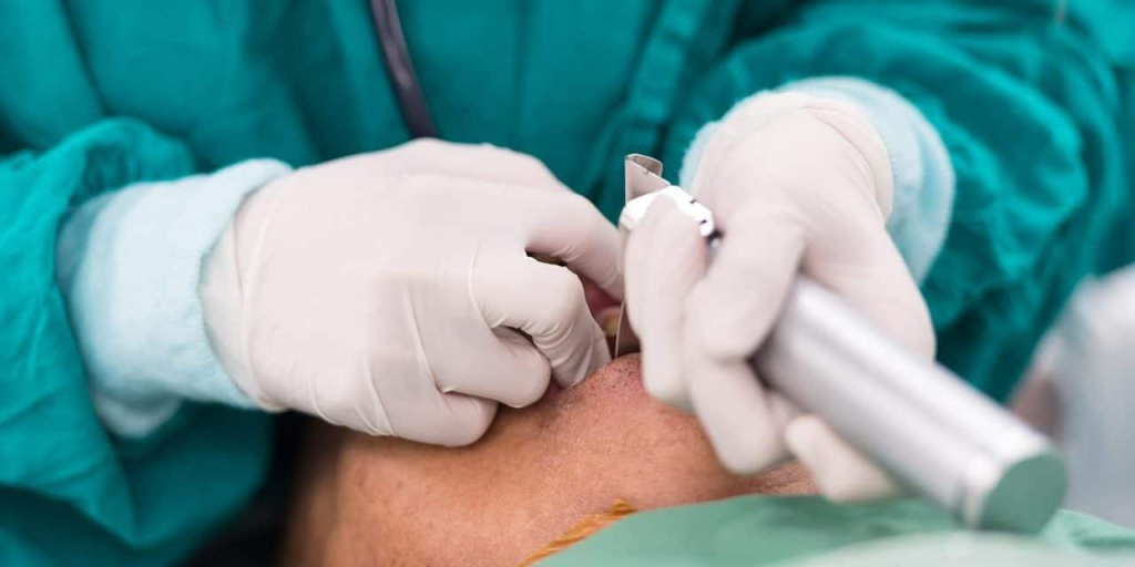 quy trình thực hiện nội soi thanh quản trực tiếp ống cứng