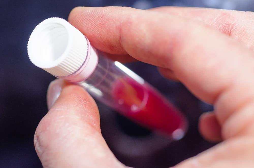 quy trình kỹ thuật xét nghiệm khí máu