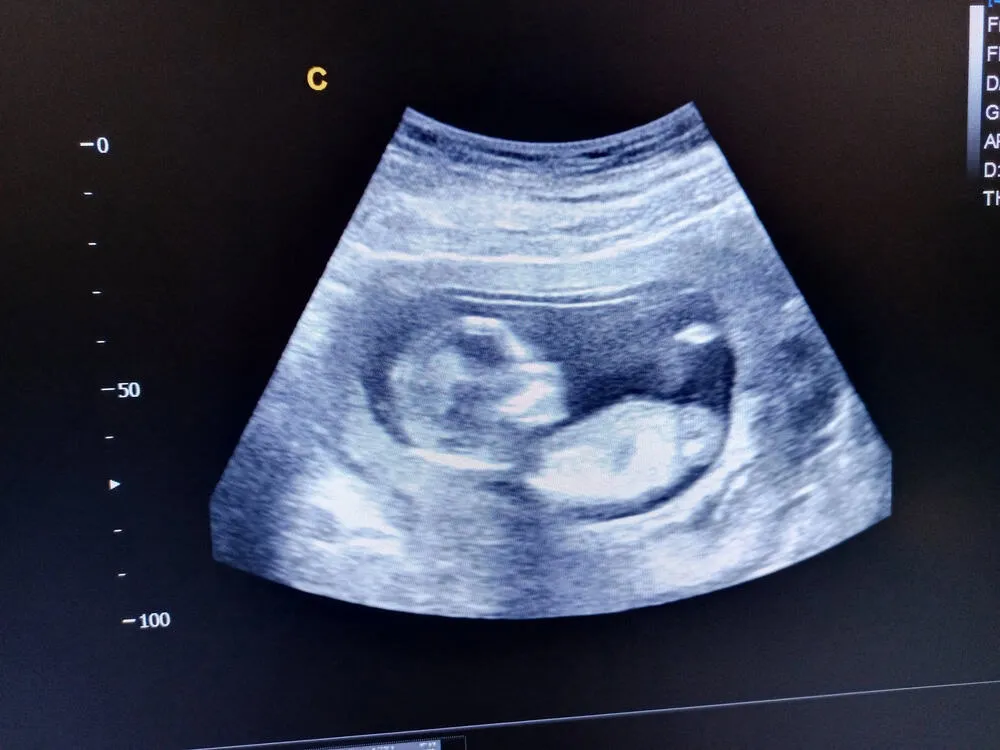 dấu hiệu thai nhi 15 tuần khỏe mạnh