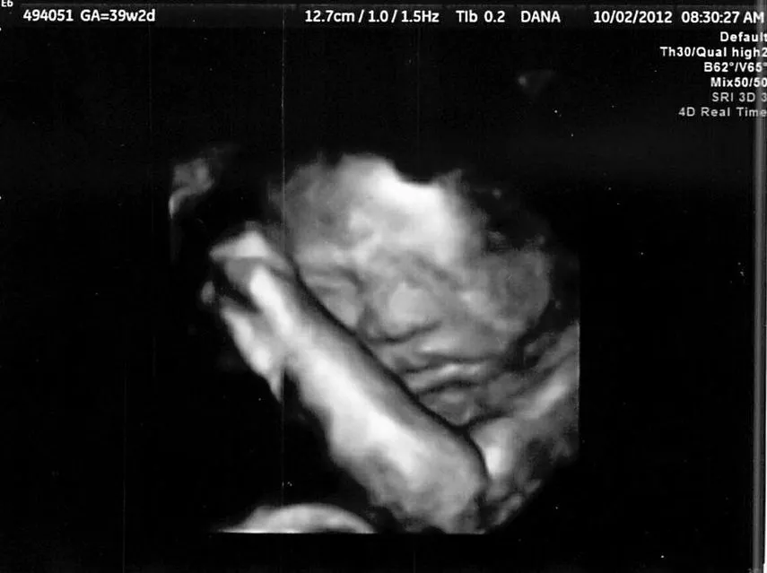 Hình ảnh siêu âm thai nhi 39 tuần 2 ngày