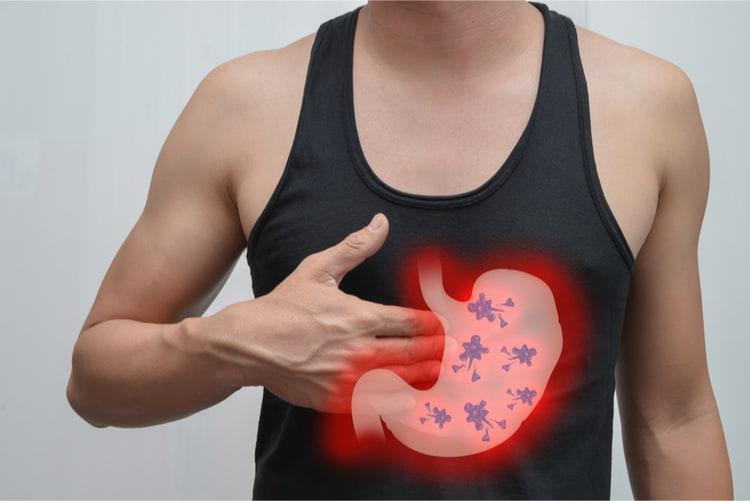 Ung thư dạ dày giai đoạn 2 sống được bao lâu