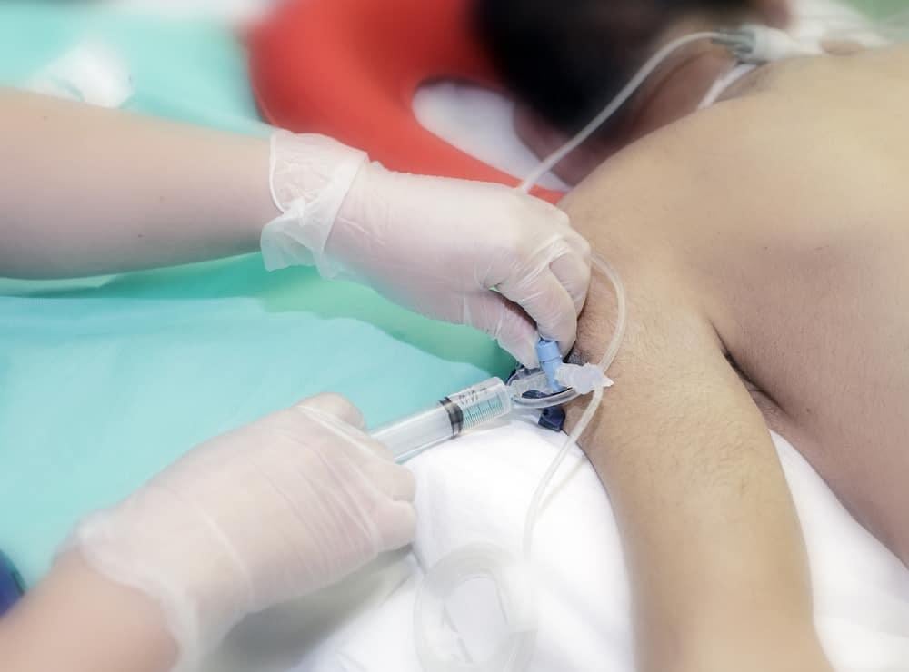 cần biết gì trước khi xét nghiệm khí máu