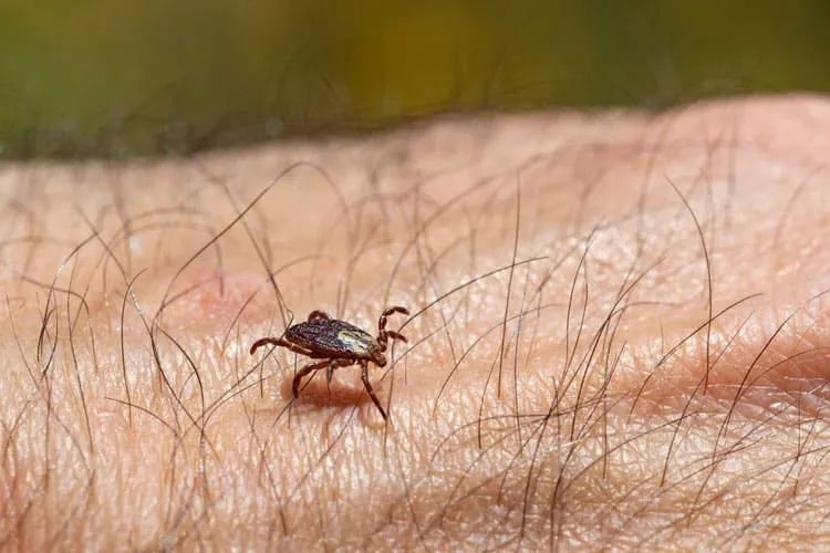 Bị ve chó cắn phải làm sao?