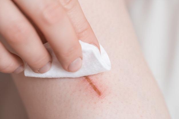 cách dùng benzalkonium chloride