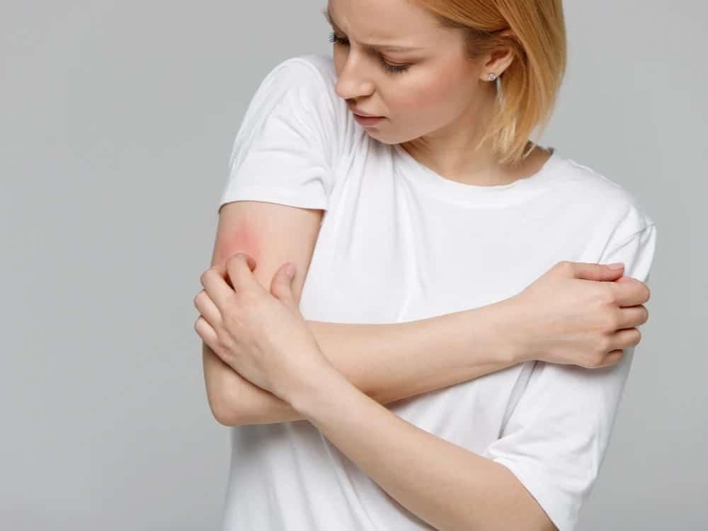 ngứa da do tác dụng phụ của kem crotamiton cream