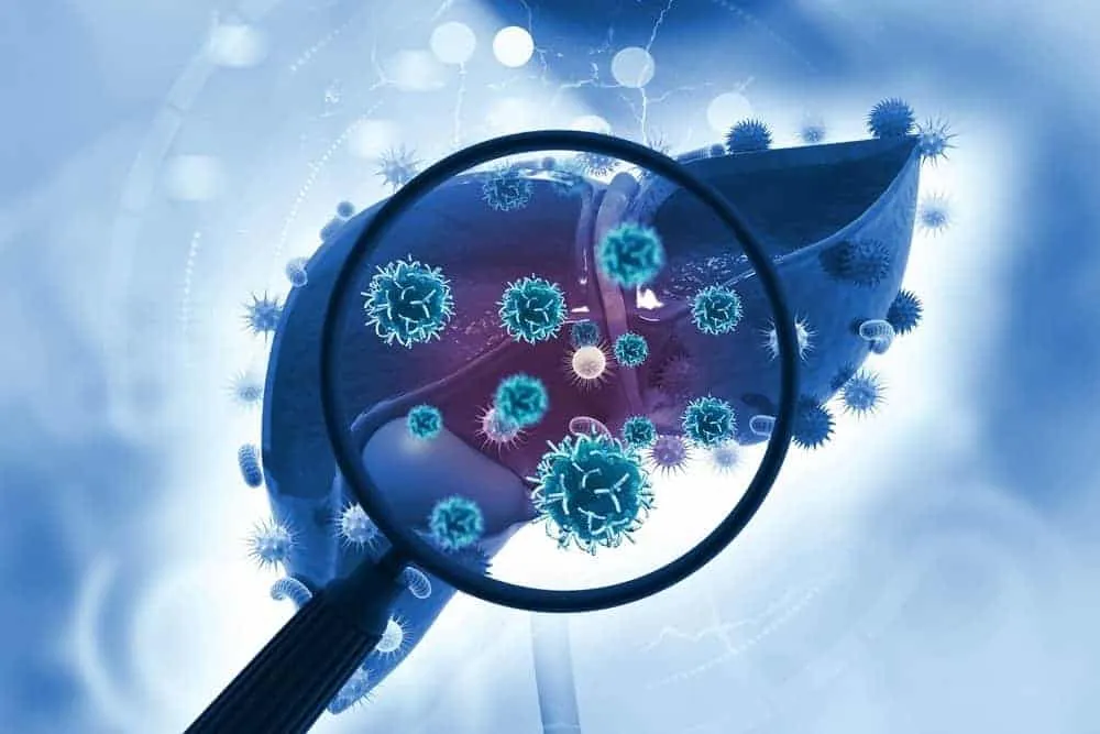 hệ thống phân loại các giai đoạn ung thư gan