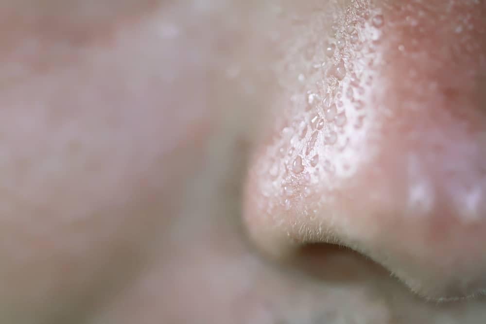 Da dầu khiến lỗ chân lông lớn