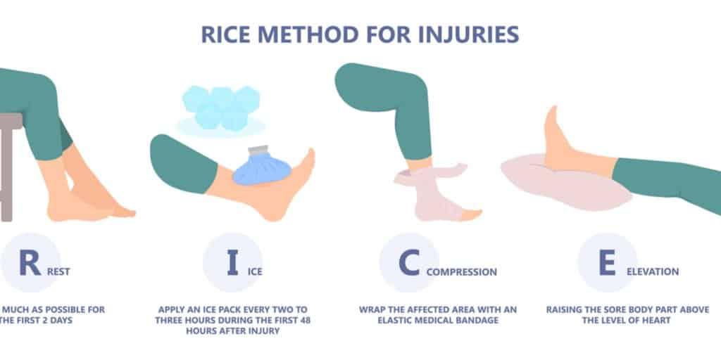 RICE cách xử lý chấn thương khi chạy bộ