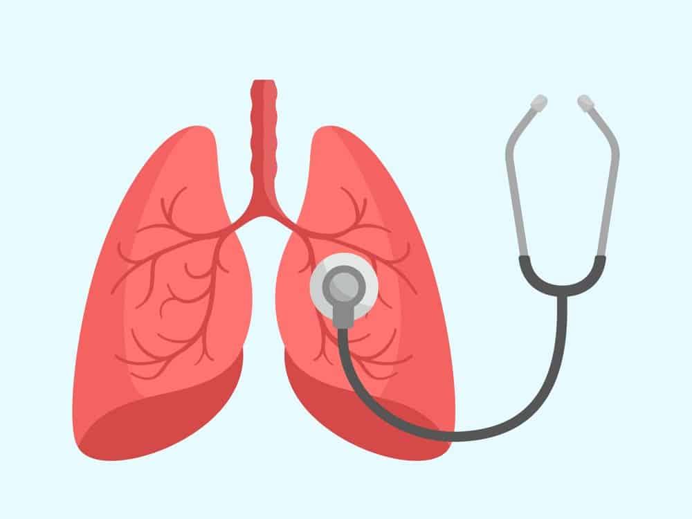 nguyên nhân gây viêm màng phổi