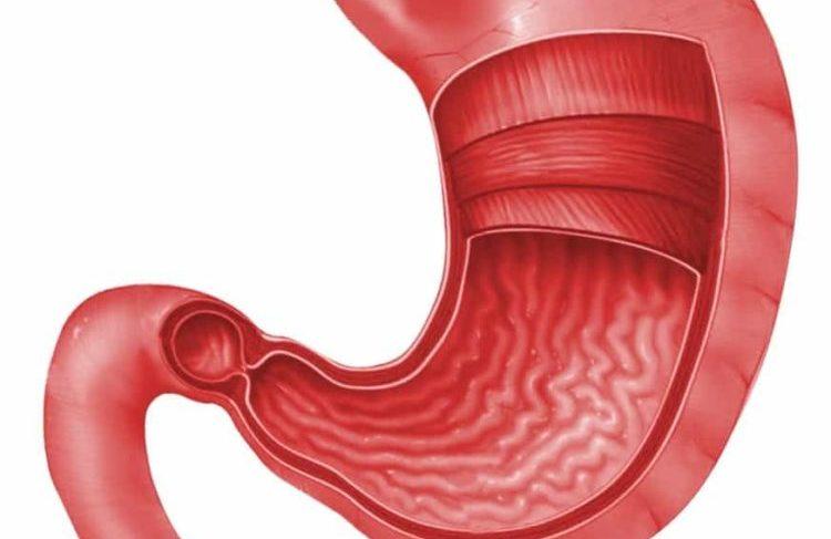 dạ dày bị viêm