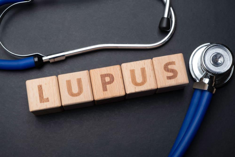 bệnh mô liên kết phổ biến là lupus ban đỏ hệ thống