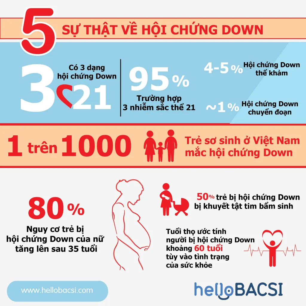 bệnh down ở trẻ sơ sinh là gì