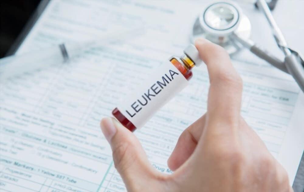 điều trị bệnh bạch cầu