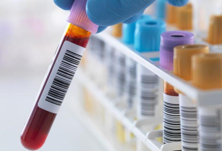 chẩn đoán bệnh viêm tụy