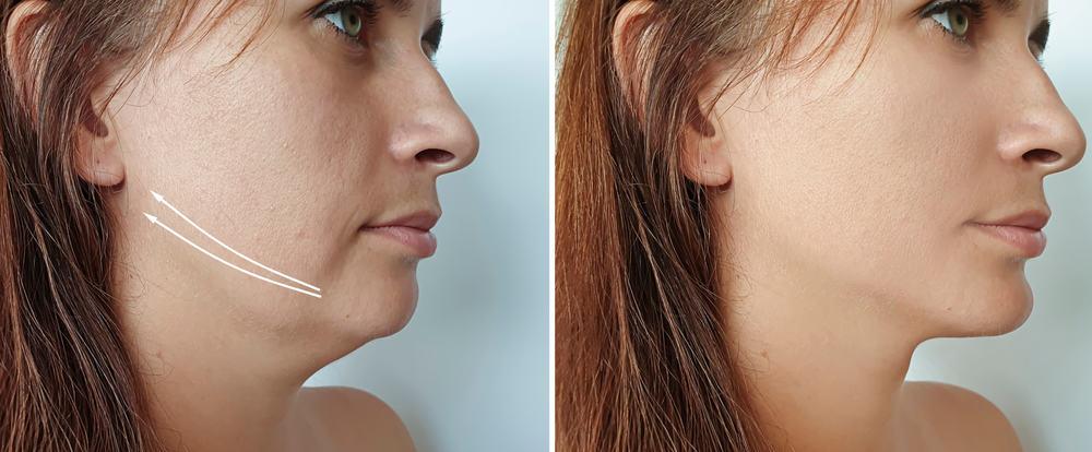 Đối tượng phù hợp nâng cơ mặt bằng chỉ