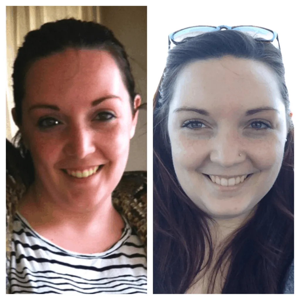 triệu chứng sưng mặt