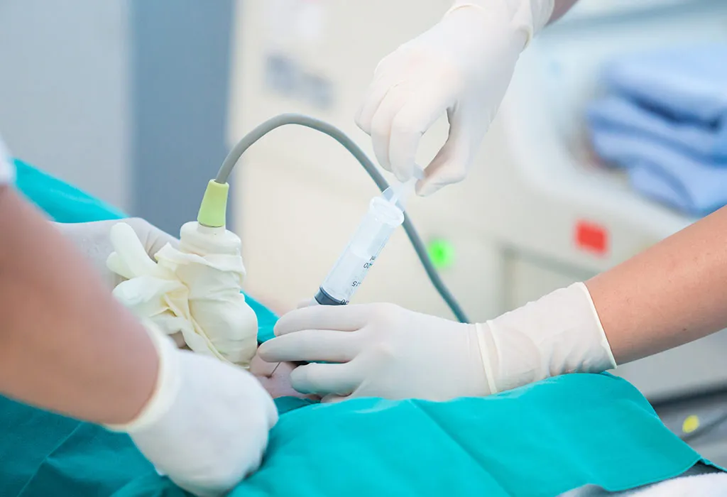 sinh thiết gai nhau