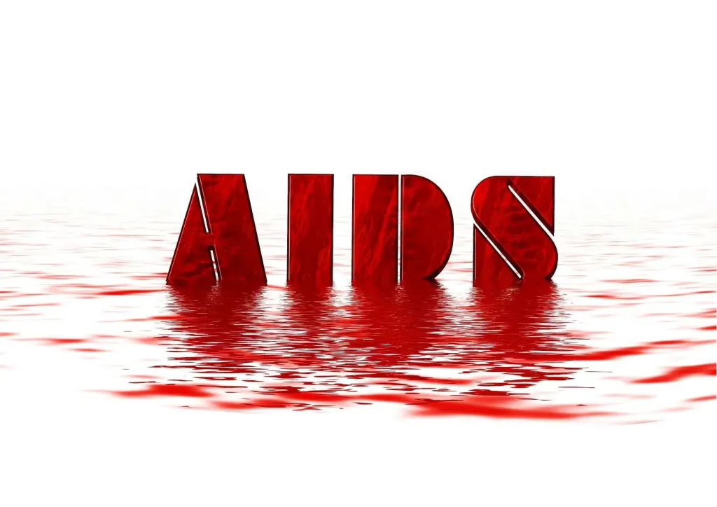 HIV aids