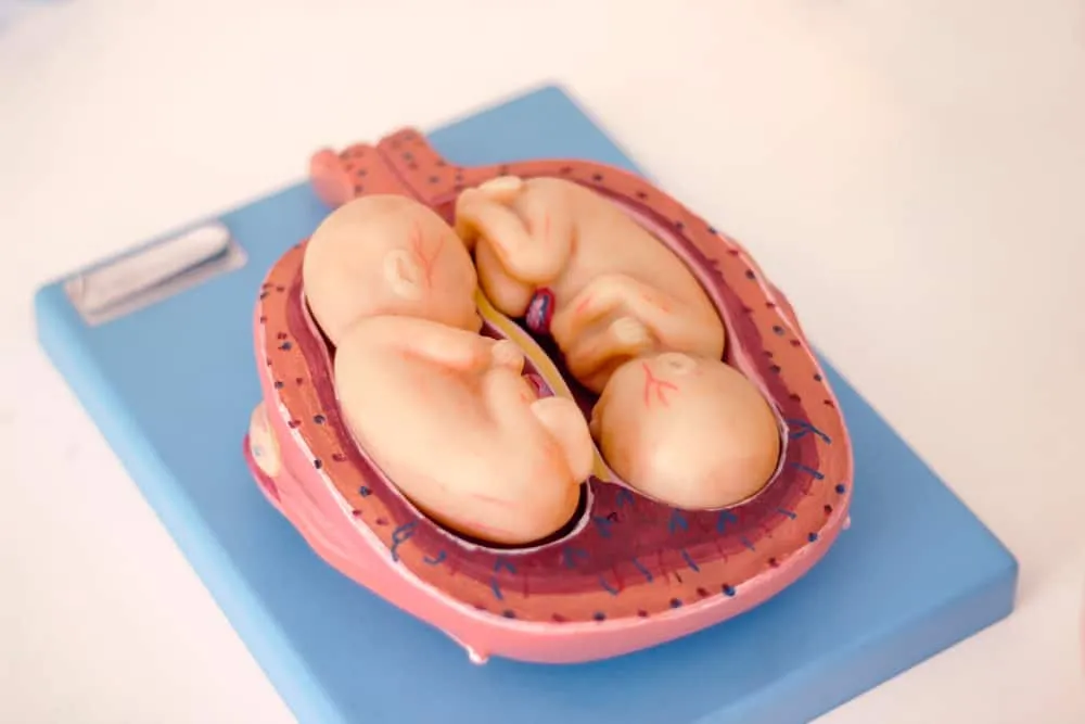 thiếu nước ối khi mang song thai