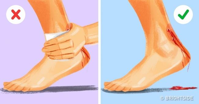 Kỹ năng sinh tồn: Sơ cứu khi bị rắn độc cắn