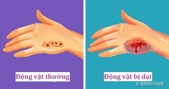 Xử lý khi bị thú dại cắn