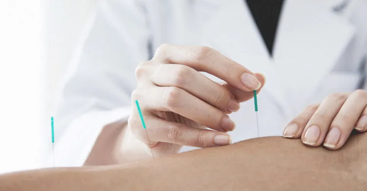 liệu pháp châm cứu chữa hen suyễn