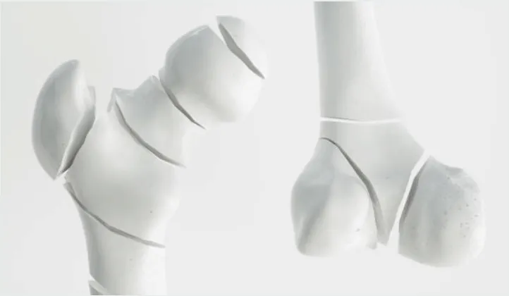 hen-suyen-co-nguy-co-bi-loang-xuong