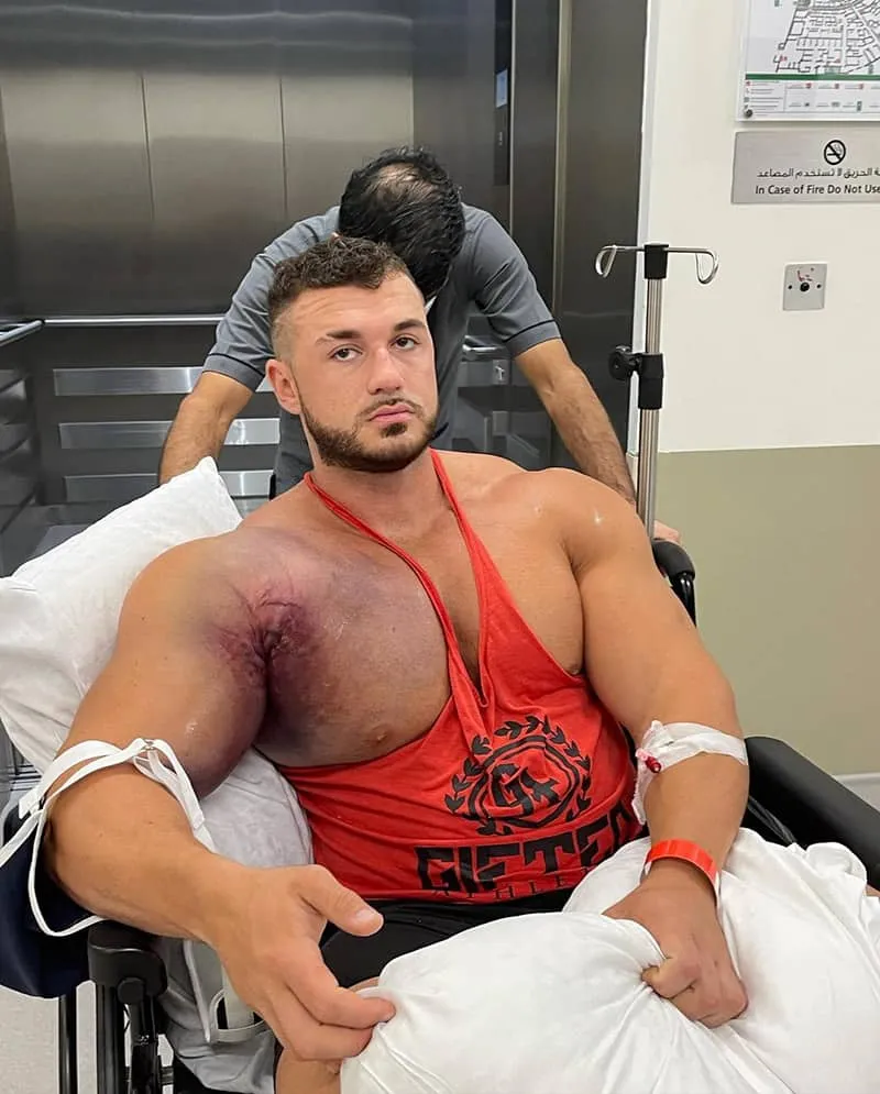 căng cơ ở vận động viên