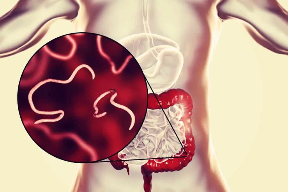 nhiễm giun kim khi mang thai 2