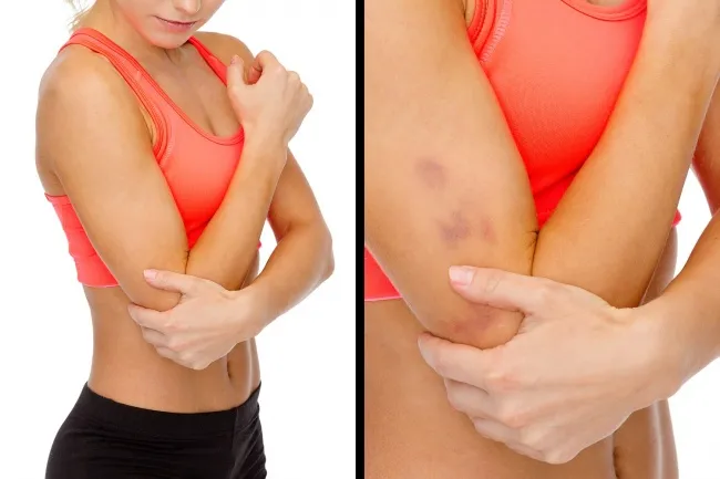 10 tác dụng phụ bạn phải đối mặt khi đi tập gym