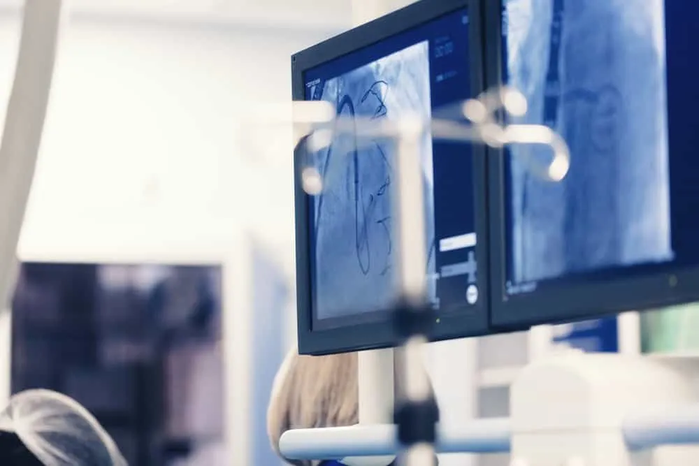 nguyên nhân gây lỗ thông bầu dục