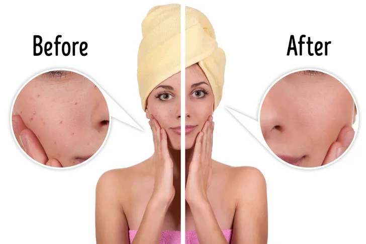 cach-tan-dung-khoai-tay_9