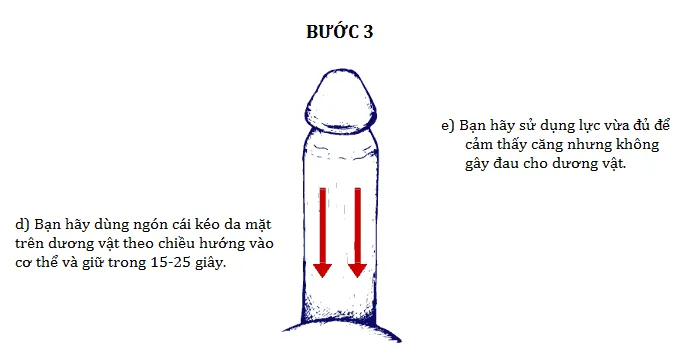Cách tăng kích thước cậu nhỏ bằng bài tập Backward Puller bước 3