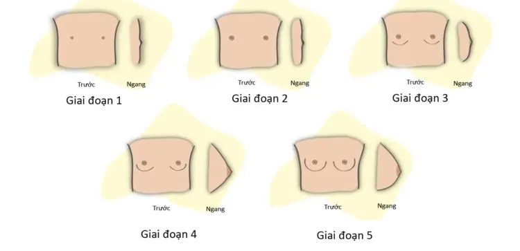 Ngực con gái tuổi dậy thì