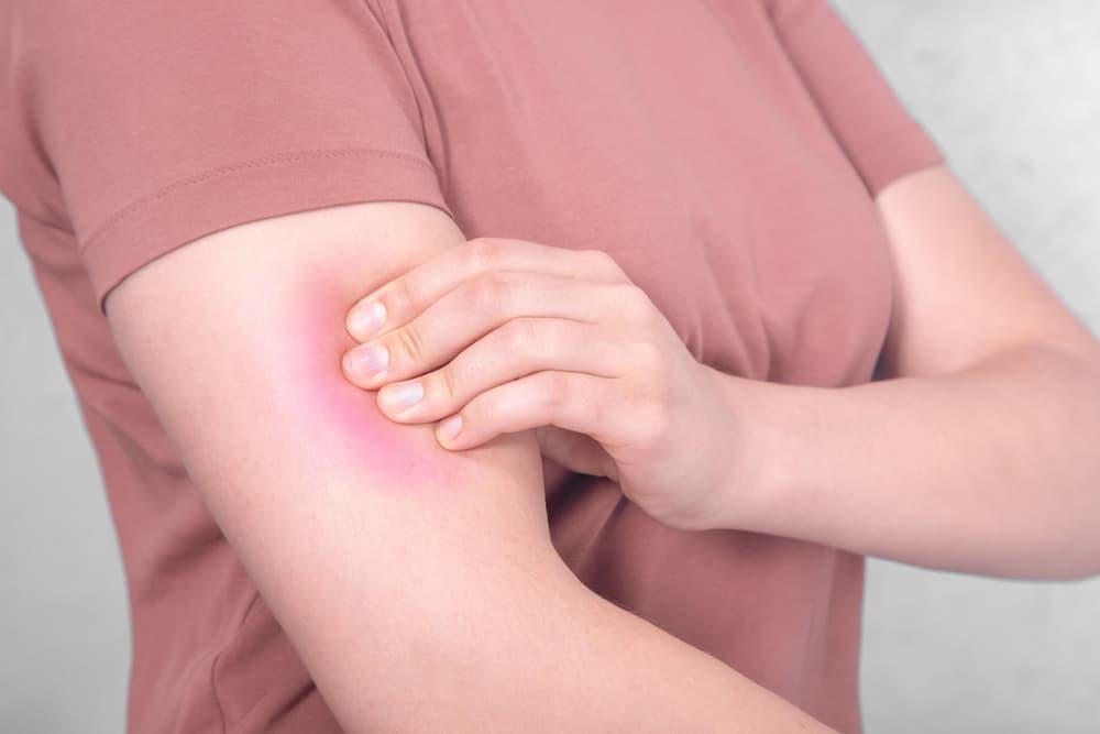 Nguyên nhân gây đau bắp tay và cách xử trí